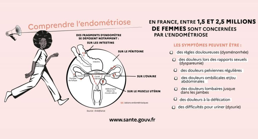 Endométriose